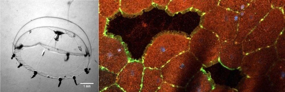Jellyfish can heal wounds in minutes. Scientists want their secrets