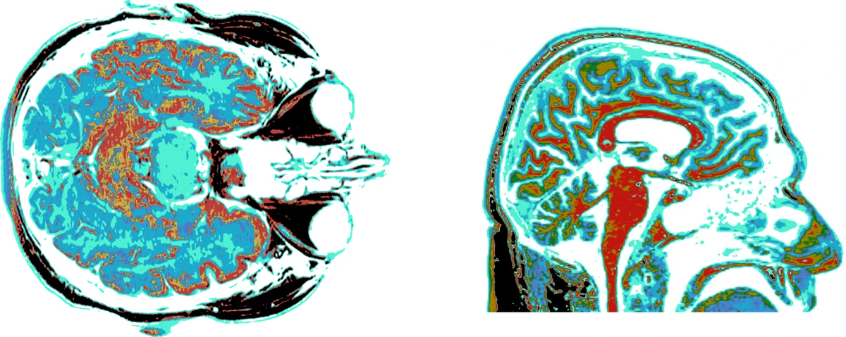 What If We Had Bigger Brains? Imagining Minds beyond Ours