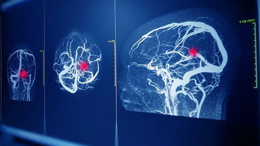 Inside the quiet reinvention of the clinical judgment call