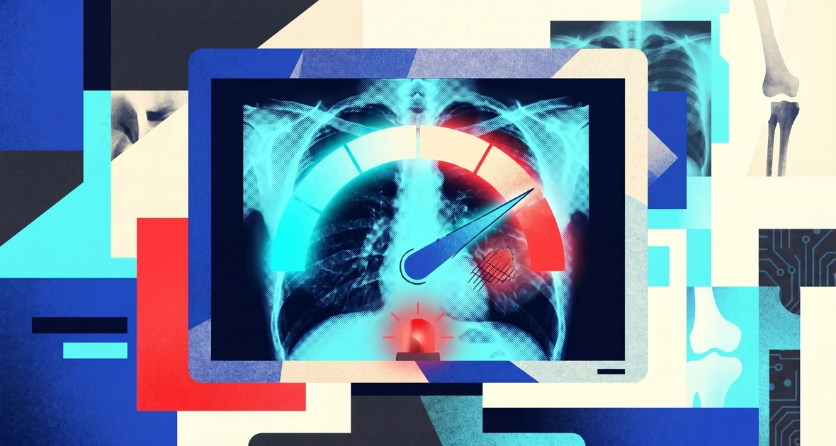 AI chatbots reading X-rays can be dangerously confident even when they're wrong