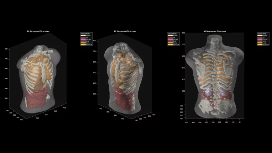 Midjourney says its new full-body scanner beats an MRI. It has never built hardware before.
