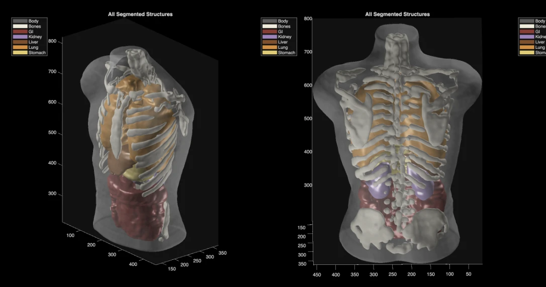 A behind-the-scenes look at Midjourney’s medical scanner leaves many questions unanswered