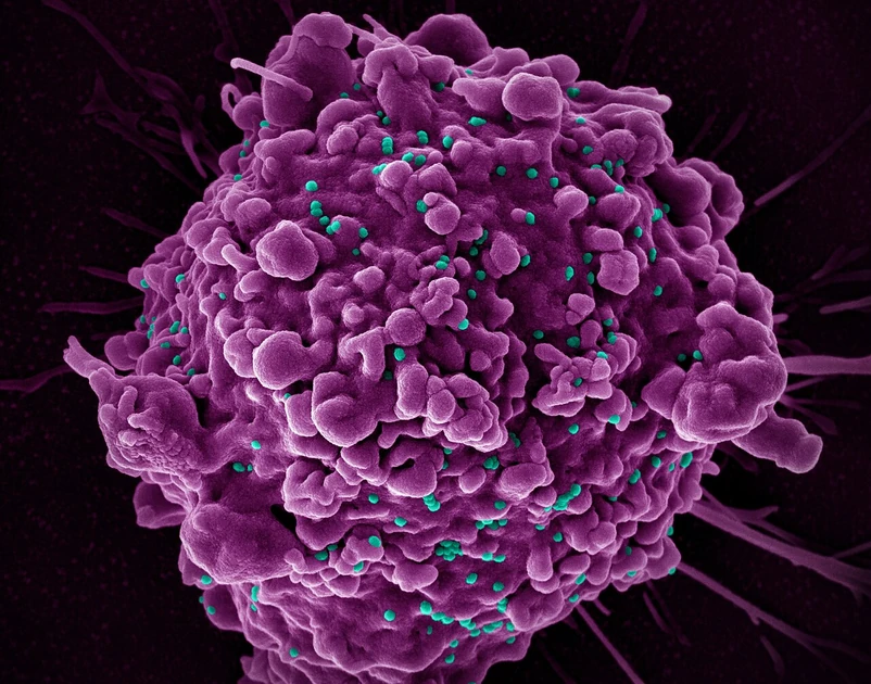 New HIV vaccine shows unprecedented success in preclinical study