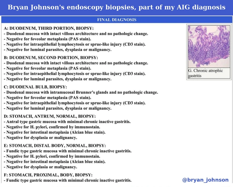 Bryan Johnson: I have an autoimmune disease. My stomach is eating itself