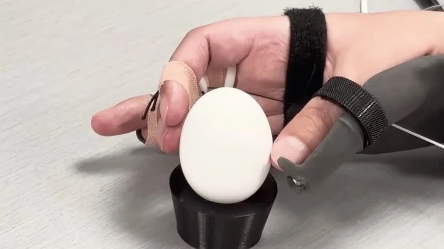 AI and a brain implant restored a paralysed man’s movement and touch