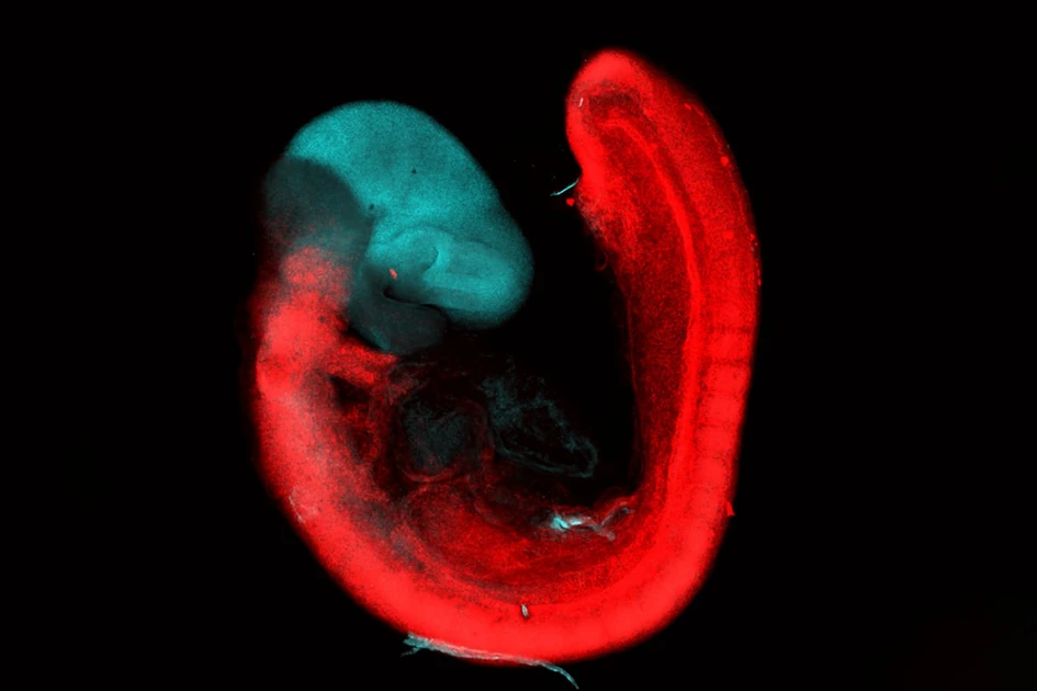 Our brain evolved from two primitive nervous systems that merged: Study